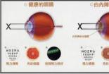 瞳孔大小：正常范围、影响因素及健康警示