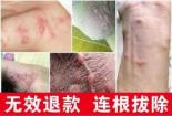 睾丸上长疙瘩：原因与防治方法