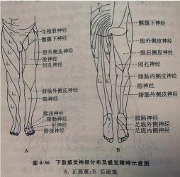 腰间盘突出怎么冶：非手术与手术的选择与日常管理