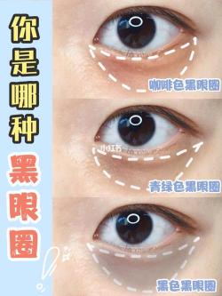 轻松告别黑眼圈：简单有效的眼周护理秘诀