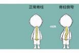 眼前的黑不是黑：揭秘眼睛黑影背后的真相与治疗方法