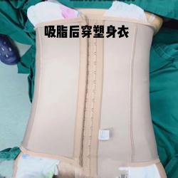 抽脂术：快速减肥背后的风险与恢复之道