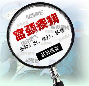 宫颈囊肿：成因、症状与应对策略，守护女性健康