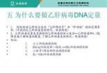 乙肝DNA检查：揭秘乙肝病情，科学制定治疗方案的关键