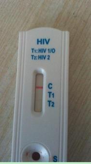 AIDS试纸：简易高效的艾滋病自我检测工具