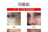 老年斑与黄褐斑的区别：年龄、分布与治疗方式的探讨