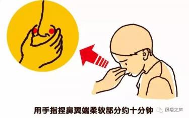 鼻子出血怎么办：应对方法和注意事项