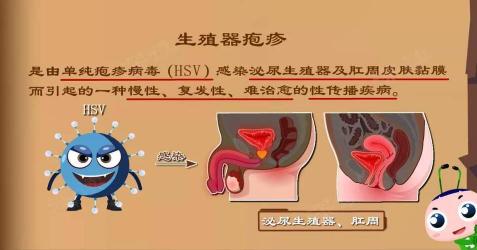 尿道口发痒：原因、应对方法和预防措施，守护泌尿健康