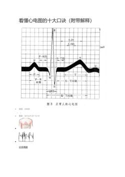 心电图怎么看：解读心脏跳动之谜