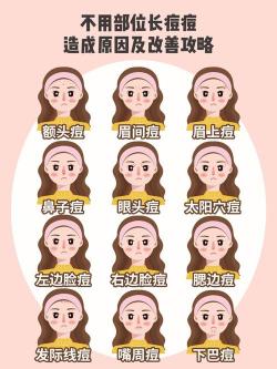 额头长痘痘：成因、影响与应对策略