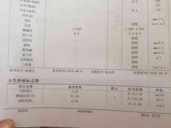 新标准！CT值大于35不再判定为阳性