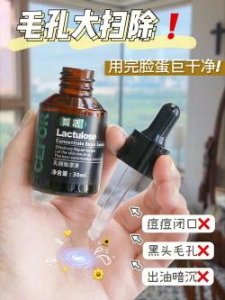 痔疮膏能治痘痘吗？专家解答痘痘治疗与注意事项